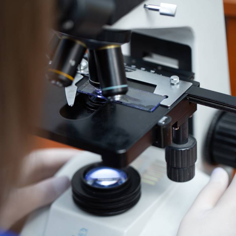 Close-up of a veterinarian using a microscope to examine a glass slide, with one hand adjusting the focus knob and the slide clearly visible under the objective lenses, possibly analyzing samples from a cat.
